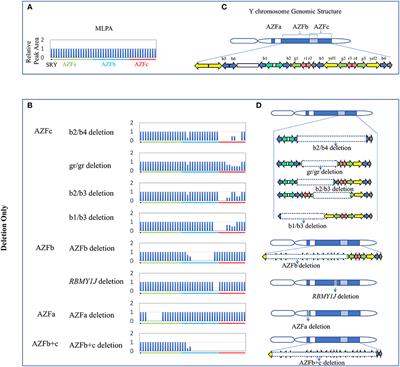 Identifying Novel Copy Number Variants in Azoospermia Factor Regions and Evaluating Their Effects on Spermatogenic Impairment